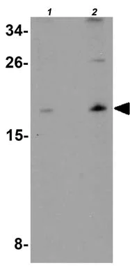 Western blot - Anti-ORMDL1 antibody (AB176122)