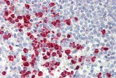 Immunohistochemistry (Formalin/PFA-fixed paraffin-embedded sections) - Anti-ORMDL3 antibody (AB211522)