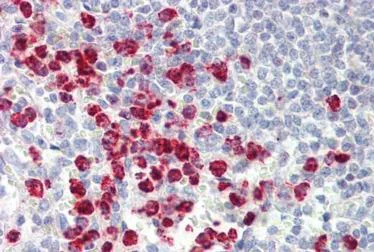 Immunohistochemistry (Formalin/PFA-fixed paraffin-embedded sections) - Anti-ORMDL3 antibody (AB211522)