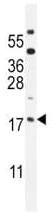 Western blot - Anti-ORMDL3 antibody (AB211522)