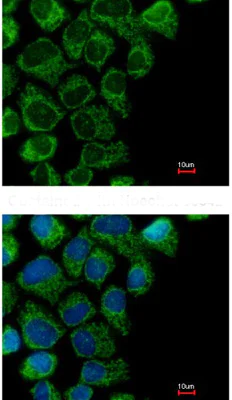 Immunocytochemistry/ Immunofluorescence - Anti-ornithine aminotransferase antibody (AB137679)
