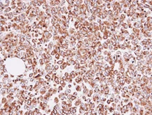Immunohistochemistry (Formalin/PFA-fixed paraffin-embedded sections) - Anti-ornithine aminotransferase antibody (AB137679)