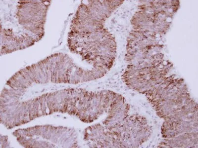 Immunohistochemistry (Formalin/PFA-fixed paraffin-embedded sections) - Anti-Ornithine Carbamoyltransferase/OTC antibody (AB228646)