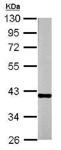 Western blot - Anti-Ornithine Carbamoyltransferase/OTC antibody (AB228646), expandable thumbnail