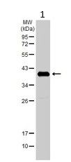 Western blot - Anti-Ornithine Carbamoyltransferase/OTC antibody (AB228646)