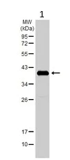 Western blot - Anti-Ornithine Carbamoyltransferase/OTC antibody (AB228646)