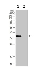 Western blot - Anti-Ornithine Carbamoyltransferase/OTC antibody (AB228646)