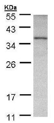 Western blot - Anti-Ornithine Carbamoyltransferase/OTC antibody (AB228646), expandable thumbnail