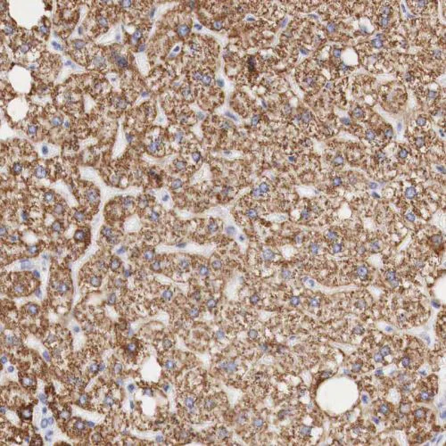 Immunohistochemistry (Formalin/PFA-fixed paraffin-embedded sections) - Anti-Ornithine Carbamoyltransferase/OTC antibody (AB244243)