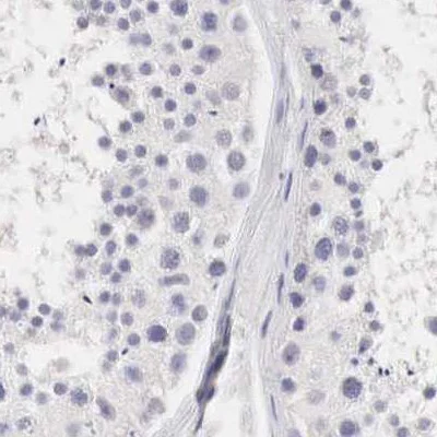 Immunohistochemistry (Formalin/PFA-fixed paraffin-embedded sections) - Anti-Ornithine Carbamoyltransferase/OTC antibody (AB244243)