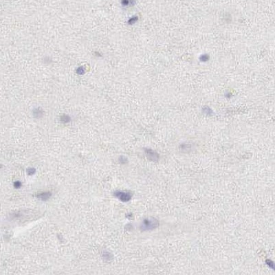 Immunohistochemistry (Formalin/PFA-fixed paraffin-embedded sections) - Anti-Ornithine Carbamoyltransferase/OTC antibody (AB244243)