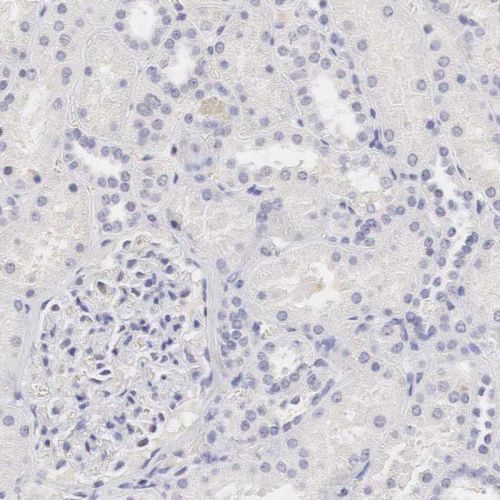 Immunohistochemistry (Formalin/PFA-fixed paraffin-embedded sections) - Anti-Ornithine Carbamoyltransferase/OTC antibody (AB244243)