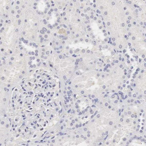 Immunohistochemistry (Formalin/PFA-fixed paraffin-embedded sections) - Anti-Ornithine Carbamoyltransferase/OTC antibody (AB244243)