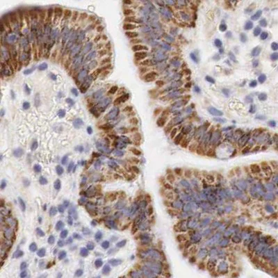Immunohistochemistry (Formalin/PFA-fixed paraffin-embedded sections) - Anti-Ornithine Carbamoyltransferase/OTC antibody (AB244243)