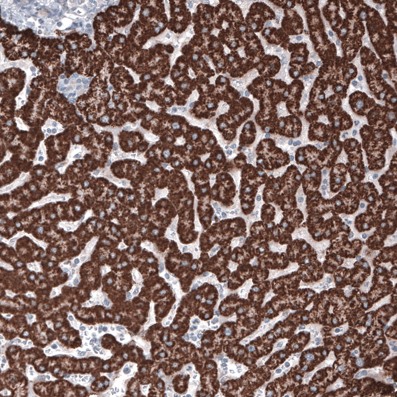 Immunohistochemistry (Formalin/PFA-fixed paraffin-embedded sections) - Anti-Ornithine Carbamoyltransferase/OTC antibody [CL4045] (ab262864), expandable thumbnail