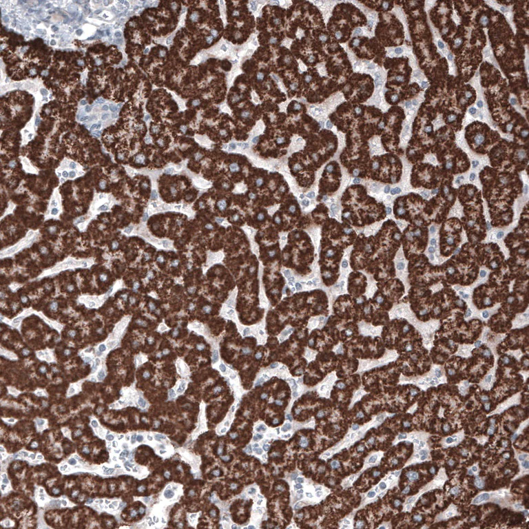 Immunohistochemistry (Formalin/PFA-fixed paraffin-embedded sections) - Anti-Ornithine Carbamoyltransferase/OTC antibody [CL4045] (AB262864)