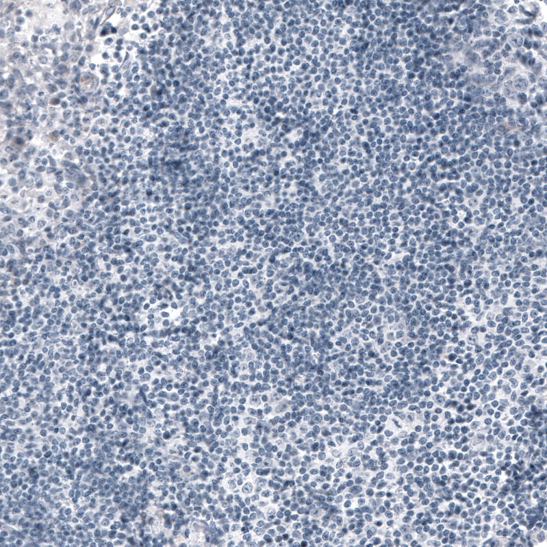 Immunohistochemistry (Formalin/PFA-fixed paraffin-embedded sections) - Anti-Ornithine Carbamoyltransferase/OTC antibody [CL4045] (AB262864), expandable thumbnail