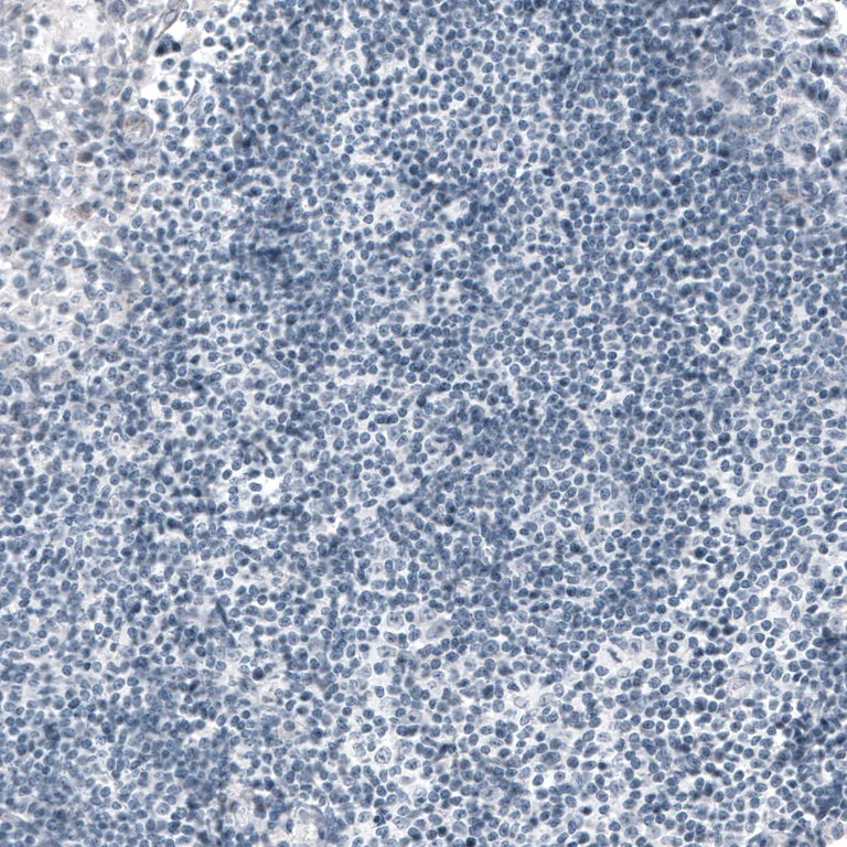 Immunohistochemistry (Formalin/PFA-fixed paraffin-embedded sections) - Anti-Ornithine Carbamoyltransferase/OTC antibody [CL4045] (AB262864)