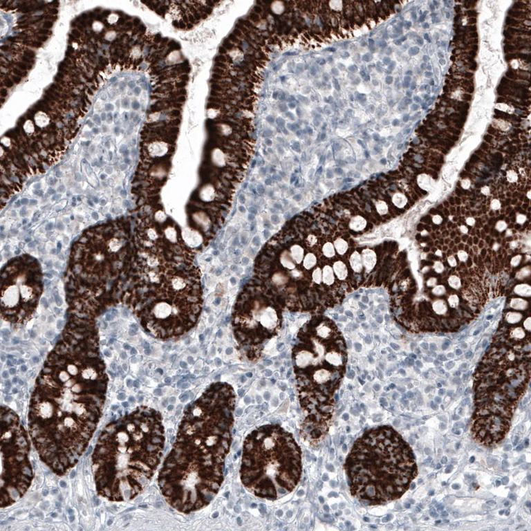 Immunohistochemistry (Formalin/PFA-fixed paraffin-embedded sections) - Anti-Ornithine Carbamoyltransferase/OTC antibody [CL4045] (AB262864)