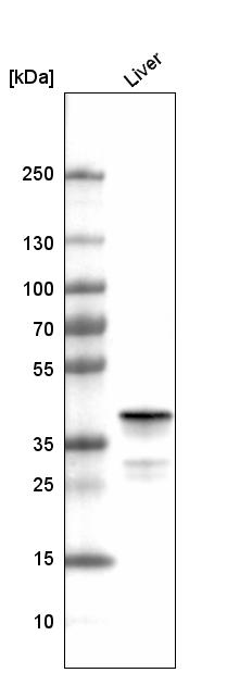 Western blot - Anti-Ornithine Carbamoyltransferase/OTC antibody [CL4045] (AB262864), expandable thumbnail
