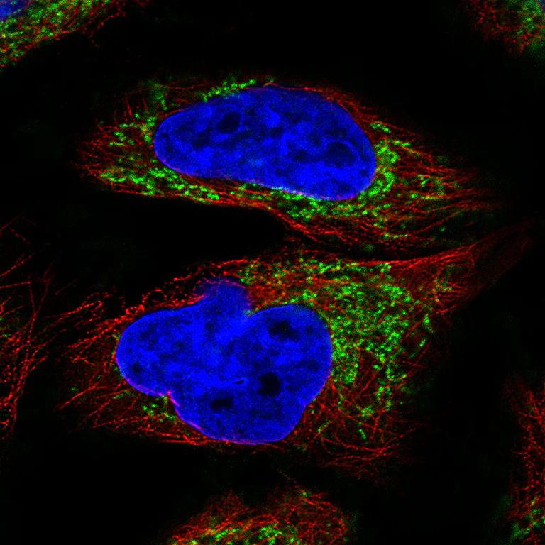 Immunocytochemistry/ Immunofluorescence - Anti-Ornithine Carbamoyltransferase/OTC antibody [CL4046] (AB262865)