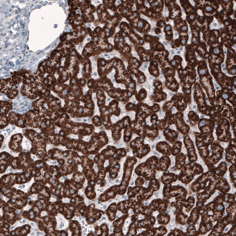 Immunohistochemistry (Formalin/PFA-fixed paraffin-embedded sections) - Anti-Ornithine Carbamoyltransferase/OTC antibody [CL4046] (AB262865)