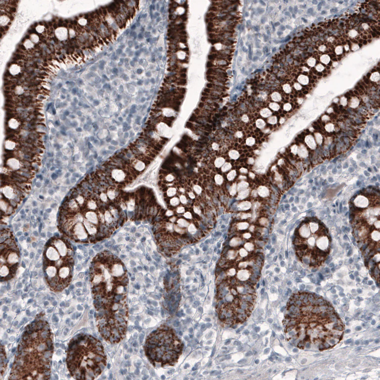 Immunohistochemistry (Formalin/PFA-fixed paraffin-embedded sections) - Anti-Ornithine Carbamoyltransferase/OTC antibody [CL4046] (AB262865)