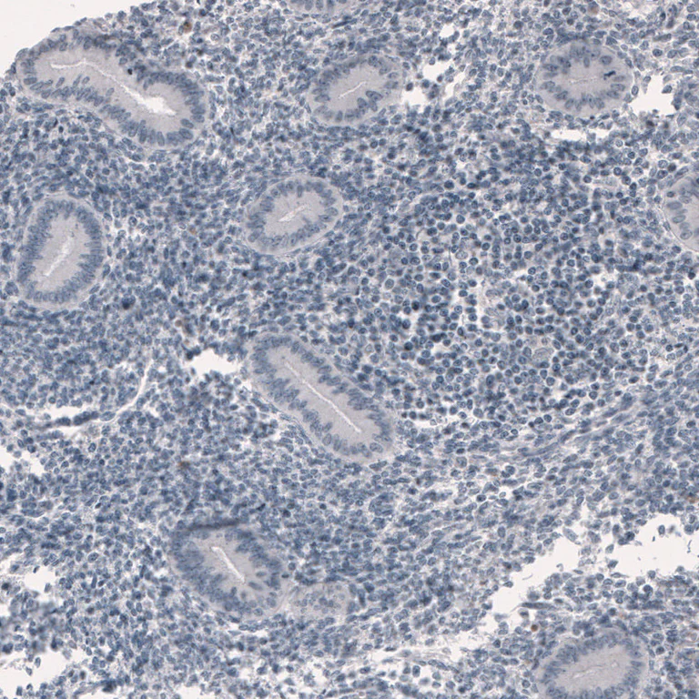 Immunohistochemistry (Formalin/PFA-fixed paraffin-embedded sections) - Anti-Ornithine Carbamoyltransferase/OTC antibody [CL4046] (AB262865)