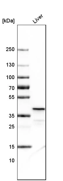 Western blot - Anti-Ornithine Carbamoyltransferase/OTC antibody [CL4046] (AB262865)