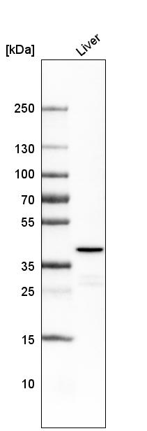 Western blot - Anti-Ornithine Carbamoyltransferase/OTC antibody [CL4049] (AB262866), expandable thumbnail