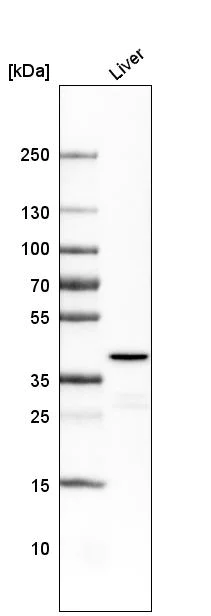 Western blot - Anti-Ornithine Carbamoyltransferase/OTC antibody [CL4049] (AB262866)