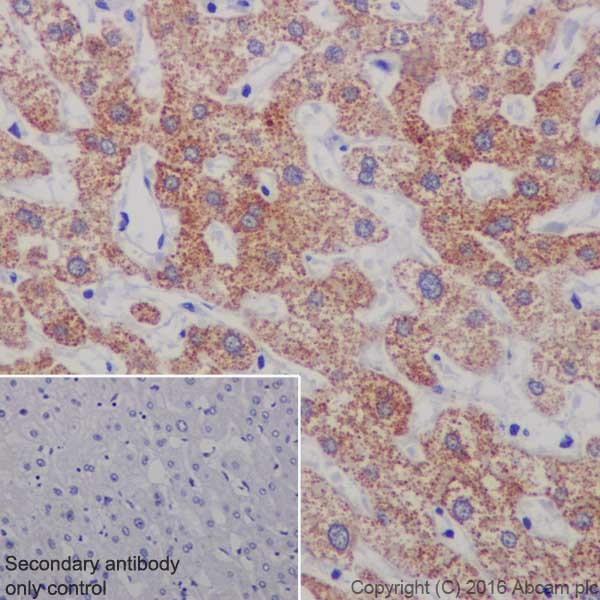 Immunohistochemistry (Formalin/PFA-fixed paraffin-embedded sections) - Anti-Ornithine Carbamoyltransferase/OTC antibody [EPR19725] (AB203859), expandable thumbnail