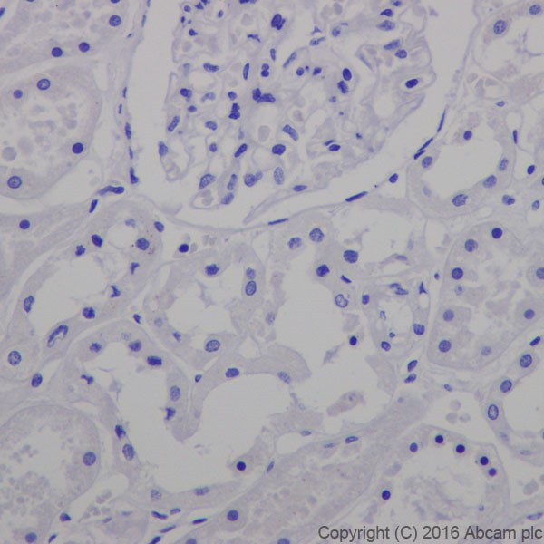 Immunohistochemistry (Formalin/PFA-fixed paraffin-embedded sections) - Anti-Ornithine Carbamoyltransferase/OTC antibody [EPR19725] (ab203859), expandable thumbnail
