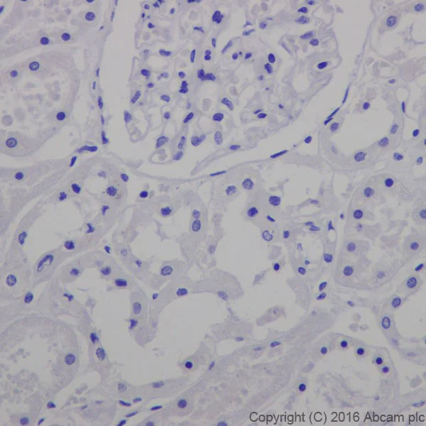 Immunohistochemistry (Formalin/PFA-fixed paraffin-embedded sections) - Anti-Ornithine Carbamoyltransferase/OTC antibody [EPR19725] (AB203859)
