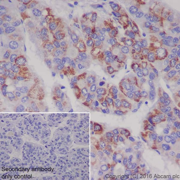 Immunohistochemistry (Formalin/PFA-fixed paraffin-embedded sections) - Anti-Ornithine Carbamoyltransferase/OTC antibody [EPR19725] (AB203859), expandable thumbnail