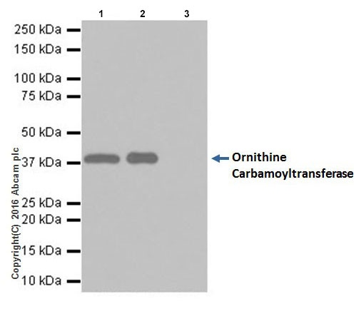 Immunoprecipitation - Anti-Ornithine Carbamoyltransferase/OTC antibody [EPR19725] (ab203859), expandable thumbnail