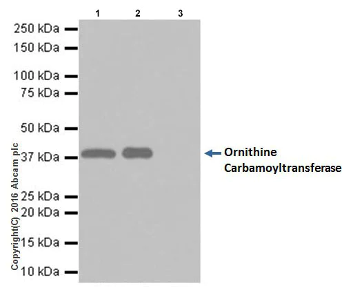 Immunoprecipitation - Anti-Ornithine Carbamoyltransferase/OTC antibody [EPR19725] (AB203859)