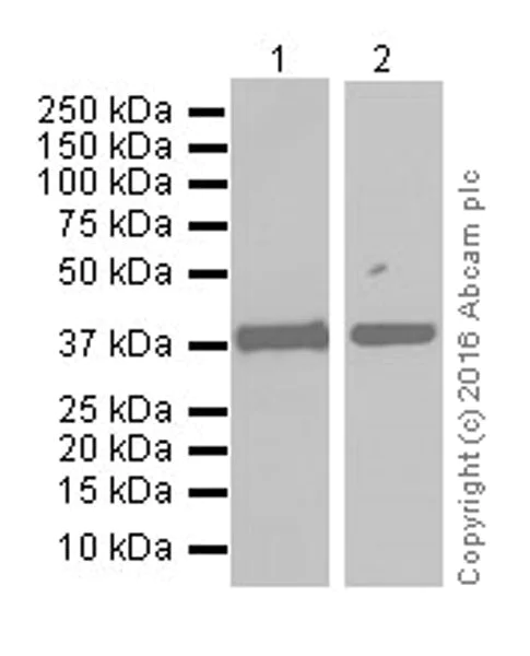 Western blot - Anti-Ornithine Carbamoyltransferase/OTC antibody [EPR19725] (AB203859)