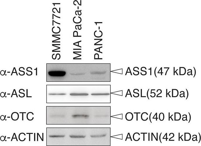 Western blot - Anti-Ornithine Carbamoyltransferase/OTC antibody [EPR19725] (ab203859), expandable thumbnail