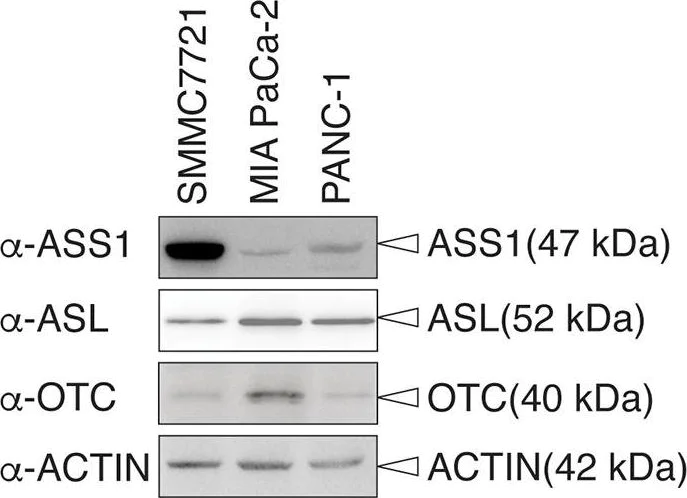 Western blot - Anti-Ornithine Carbamoyltransferase/OTC antibody [EPR19725] (AB203859)