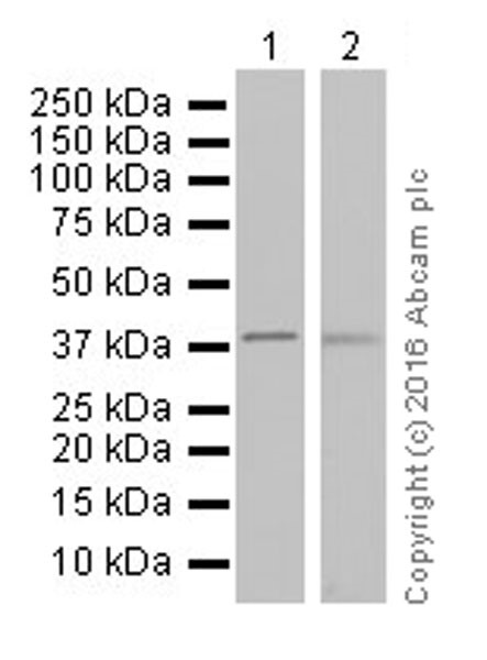 Western blot - Anti-Ornithine Carbamoyltransferase/OTC antibody [EPR19725] (AB203859), expandable thumbnail