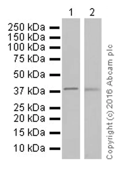 Western blot - Anti-Ornithine Carbamoyltransferase/OTC antibody [EPR19725] (AB203859)