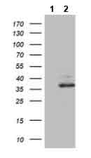 Western blot - Anti-Ornithine Carbamoyltransferase/OTC antibody [OTI8A1] (AB180401)