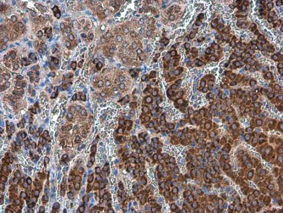 Immunohistochemistry (Formalin/PFA-fixed paraffin-embedded sections) - Anti-Ornithine Decarboxylase/ODC antibody (AB97395)