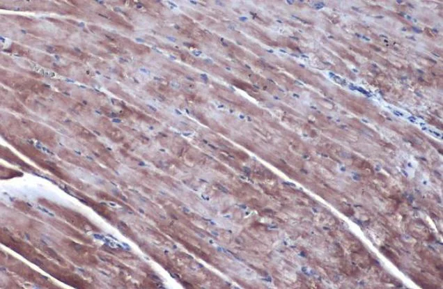 Immunohistochemistry (Formalin/PFA-fixed paraffin-embedded sections) - Anti-Ornithine Decarboxylase/ODC antibody (AB97395)