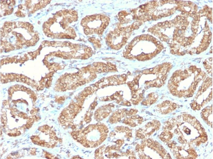 Immunohistochemistry (Formalin/PFA-fixed paraffin-embedded sections) - Anti-Ornithine Decarboxylase/ODC antibody [ODC1/2878R] (AB270268), expandable thumbnail
