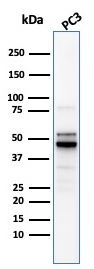 Western blot - Anti-Ornithine Decarboxylase/ODC antibody [ODC1/2878R] (AB270268), expandable thumbnail