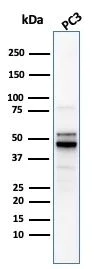 Western blot - Anti-Ornithine Decarboxylase/ODC antibody [ODC1/2878R] (AB270268)