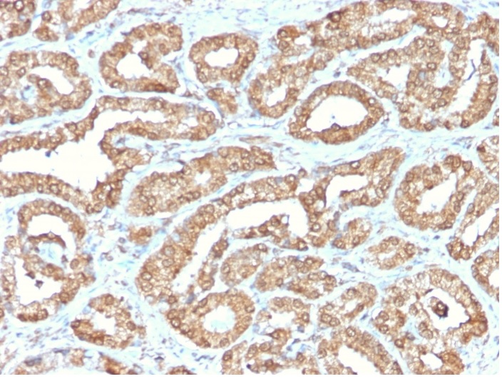 Immunohistochemistry (Formalin/PFA-fixed paraffin-embedded sections) - Anti-Ornithine Decarboxylase/ODC antibody [ODC1/2878R] - BSA and Azide free (AB270299)