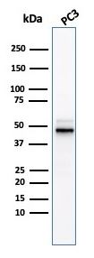 Western blot - Anti-Ornithine Decarboxylase/ODC antibody [ODC1/3636R] (AB270269), expandable thumbnail